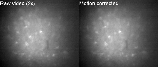 Motion correction demo